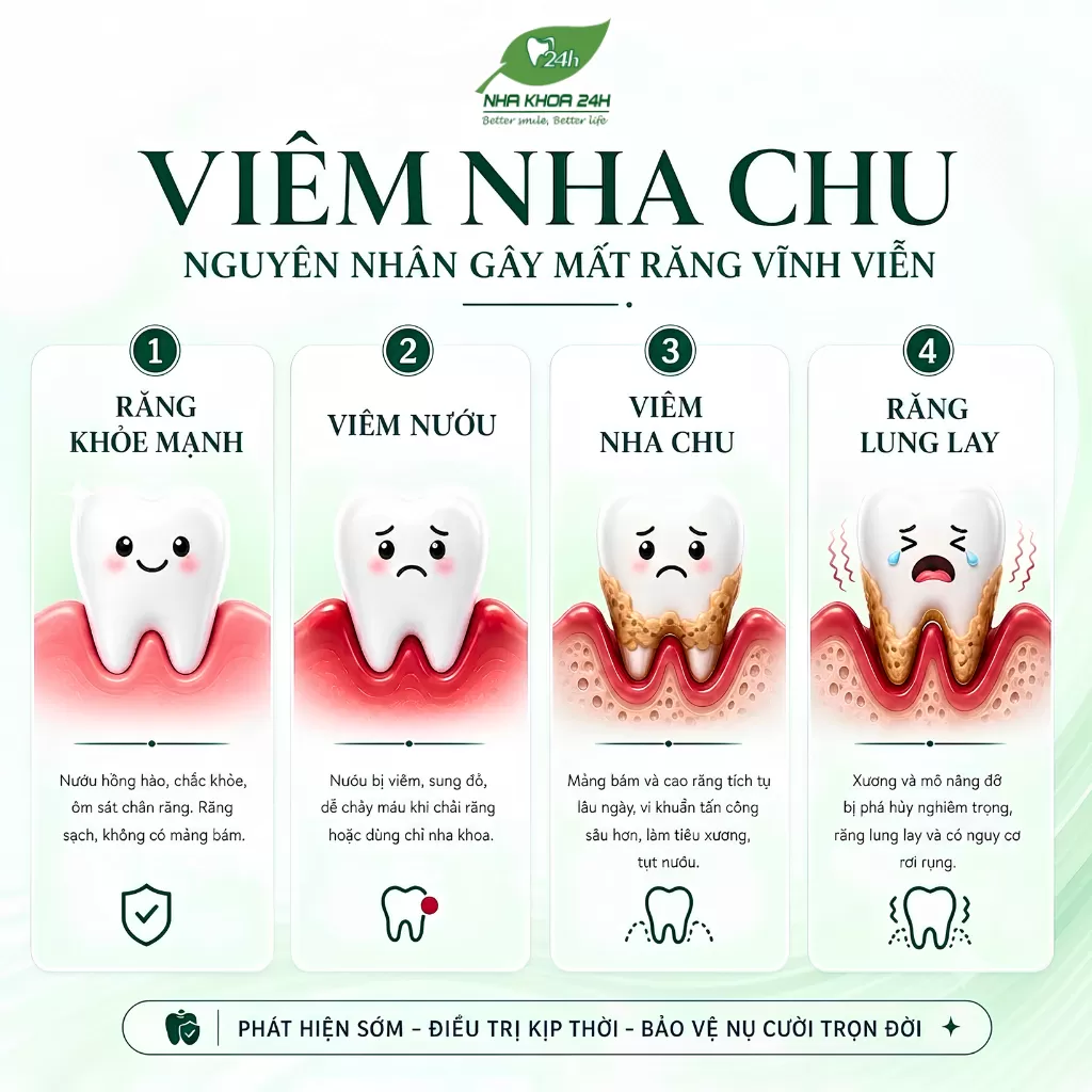 Viêm Nha Chu: Nguyên Nhân Thầm Lặng Gây Mất Răng Vĩnh Viễn