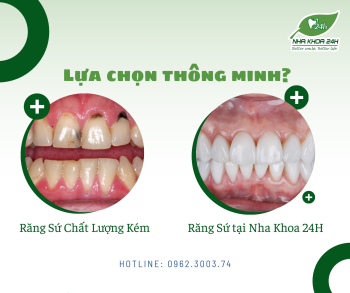 ĐIỀU GÌ TẠO NÊN SỰ KHÁC BIỆT KHI LÀM RĂNG TẠI NHA KHOA 24H