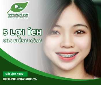 LỢI ÍCH KHI NIỀNG RĂNG?