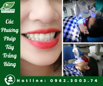 CÁC PHƯƠNG PHÁP TẨY TRẮNG RĂNG
