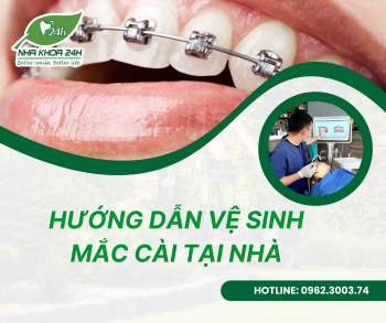 CÁCH VỆ SINH MẮC CÀI TẠI NHÀ