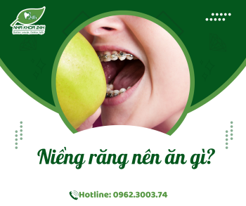 NIỀNG RĂNG NÊN ĂN GÌ?