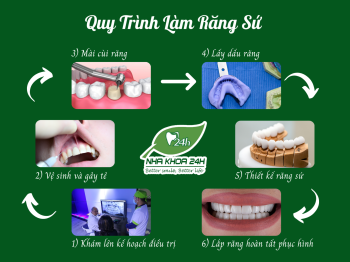 QUY TRÌNH LÀM RĂNG SỨ CHUYÊN NGHIỆP TẠI NHA KHOA 24H