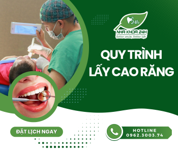 QUY TRÌNH LẤY CAO RĂNG