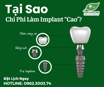 TẠI SAO CHI PHÍ LÀM IMPLANT LẠI CAO