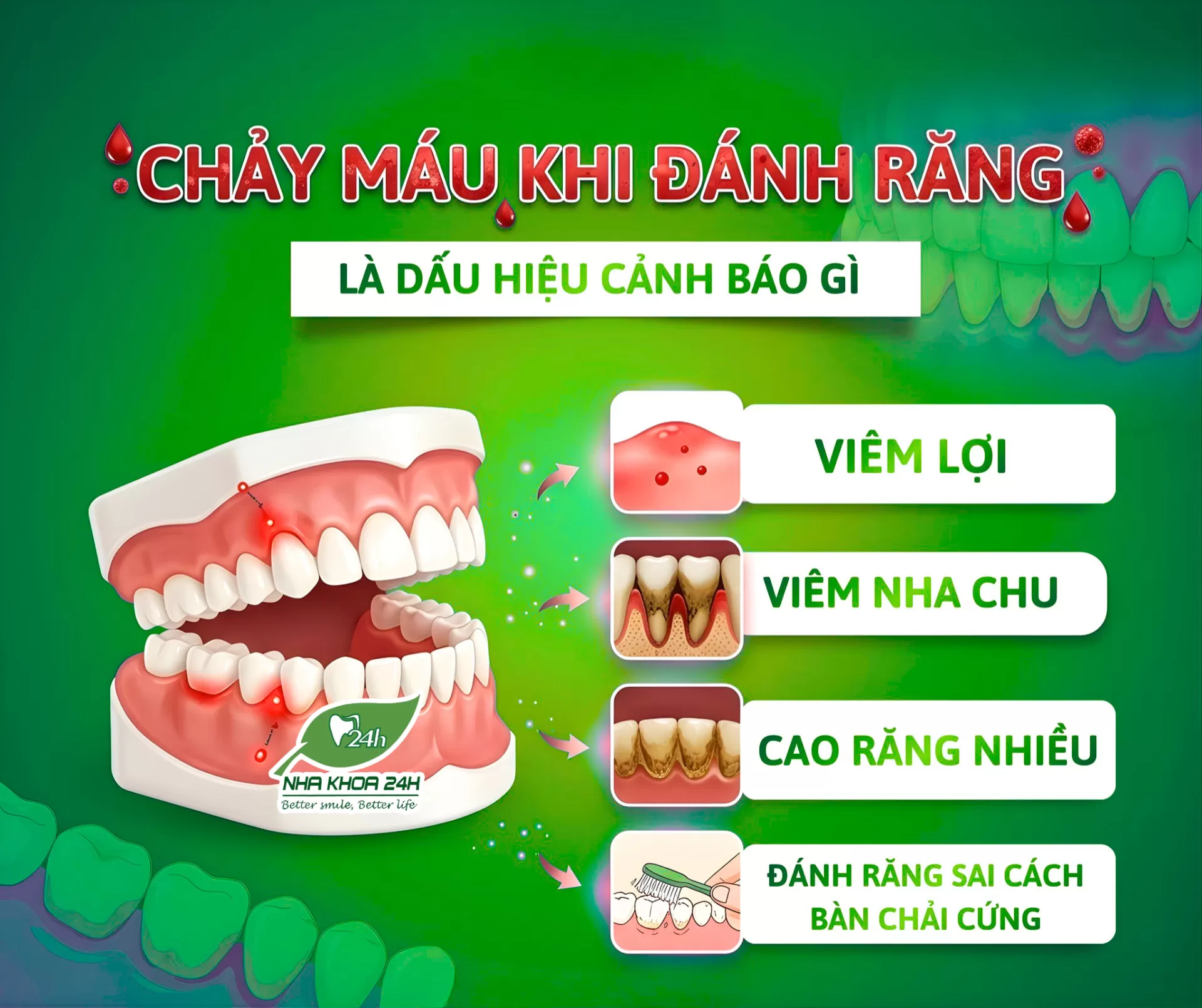 ? Chảy máu khi đánh răng là dấu hiệu cảnh báo gì?