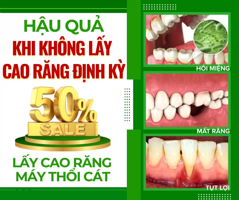 HẬU QUẢ KHI KHÔNG LẤY CAO RĂNG ĐỊNH KỲ