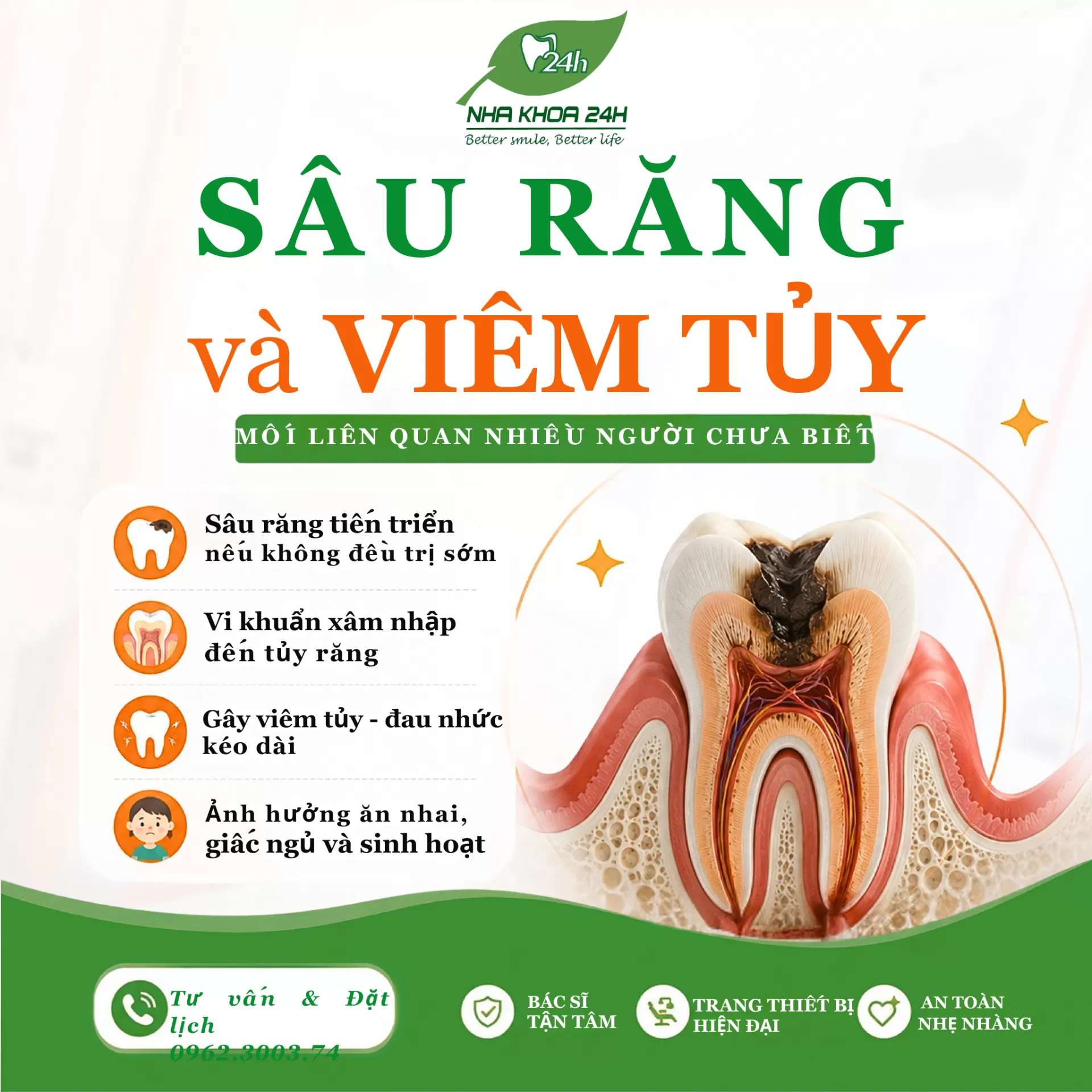 Sâu răng và viêm tủy: Mối liên quan nhiều người chưa biết