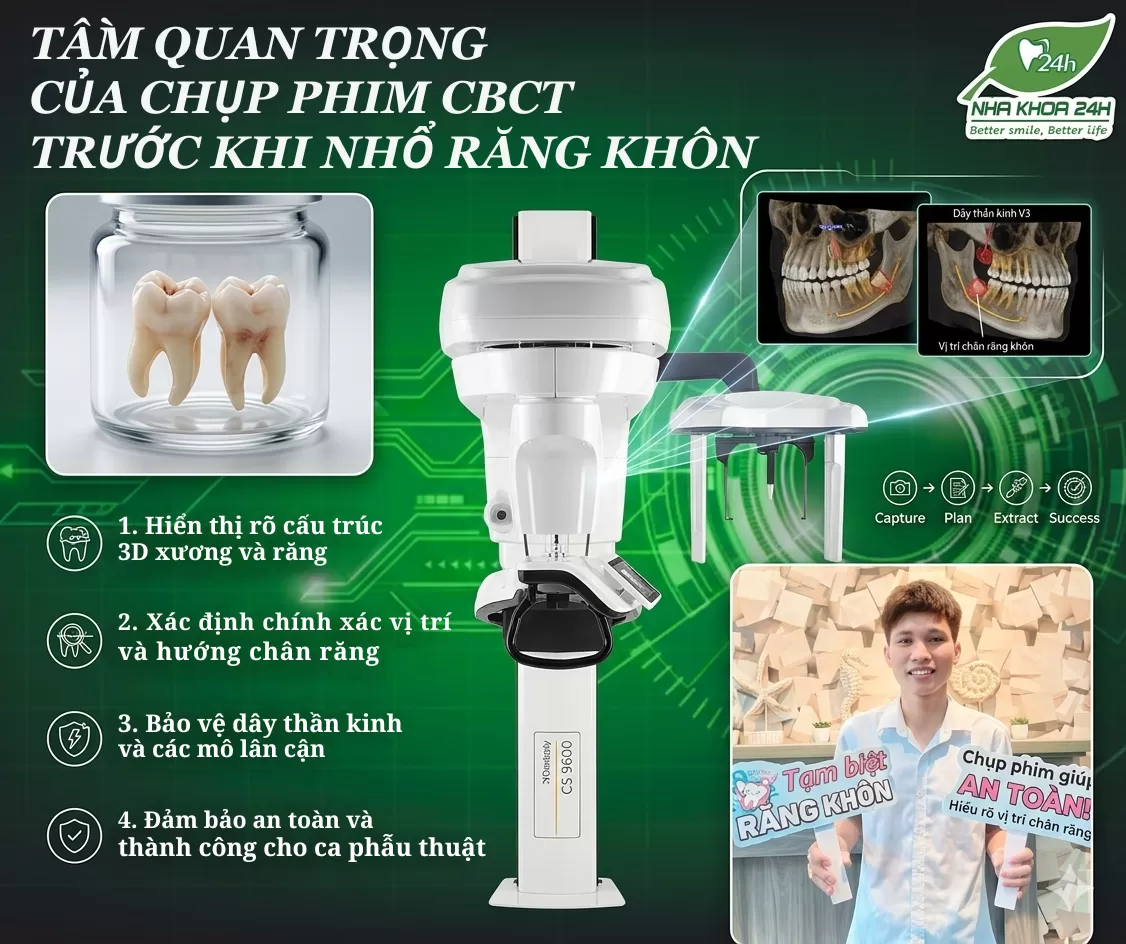 TẦM QUAN TRỌNG CỦA CHỤP PHIM CBCT TRƯỚC KHI NHỔ RĂNG KHÔN