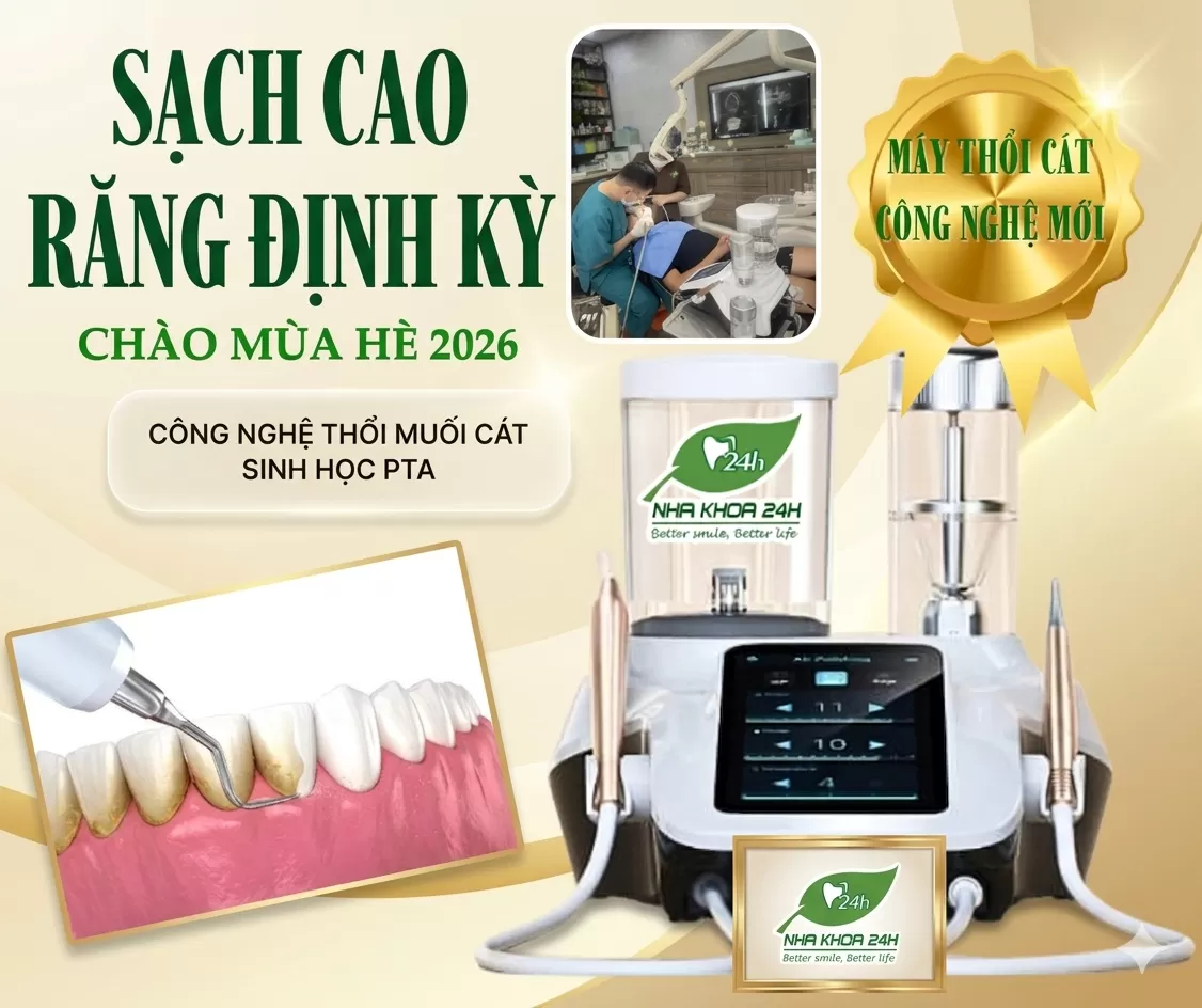 Sạch Cao Răng Định Kỳ – Chào Mùa Hè 2026 ✨