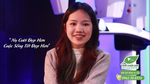 Phỏng Vấn BN Chỉnh Nha Tại Nha Khoa 24H TP. Hòa Bình